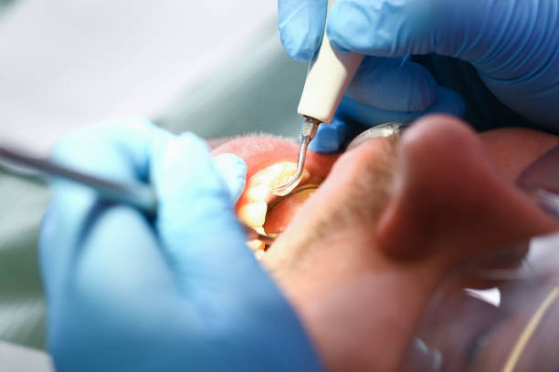 Best Walk-In Emergency Dentist in Terrace Heights, WA