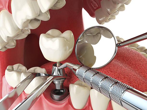 Best Pediatric Emergency Dentist in Terrace Heights, WA