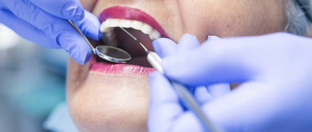 Best Emergency Treatment for Toothache in Terrace Heights, WA
